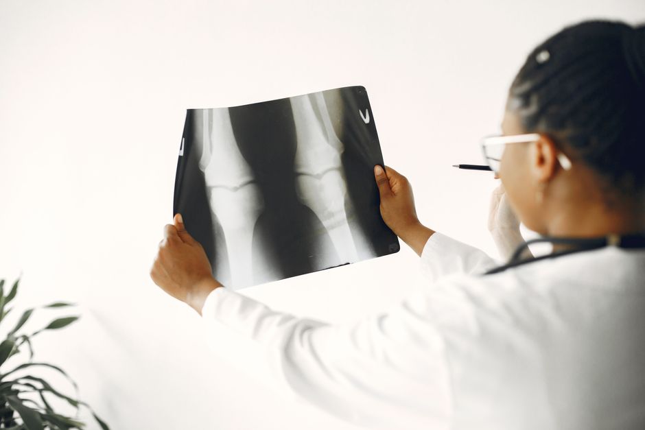 ACL Reconstruction