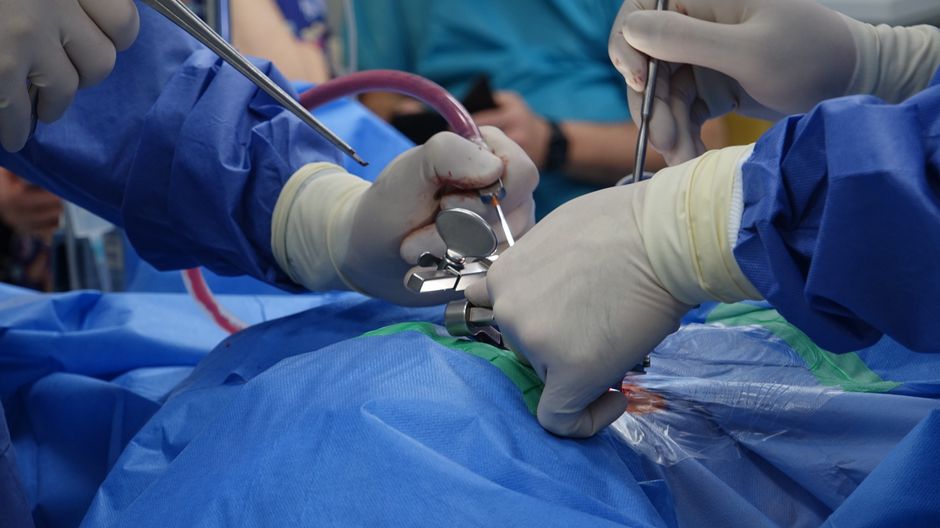 Brain Tumor Surgery