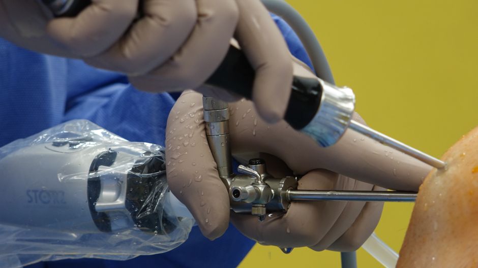 Colonoscopy Screening