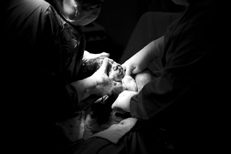 Congenital Heart Defect Surgery