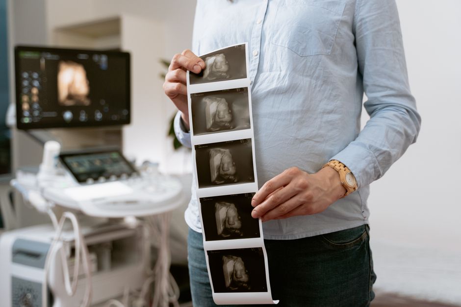 Echocardiogram heart ultrasound performed as part of cardiac screening in Korea