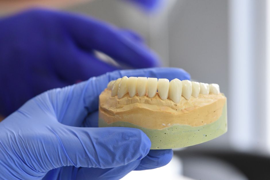 Patient showing natural-looking ceramic inlay result after conservative dentistry treatment