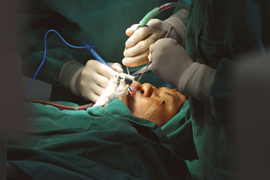 Facelift surgery at a Korean plastic surgery clinic
