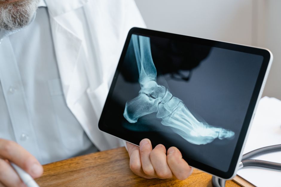 Orthopedic consultation reviewing leg X-rays before limb lengthening surgery in Korea
