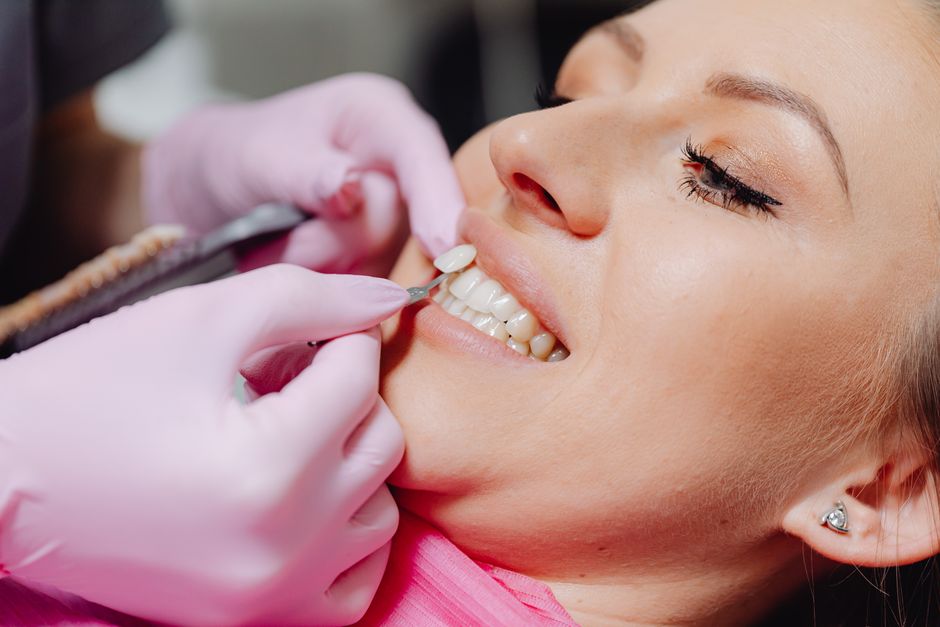 Porcelain veneer placement at a Korean dental clinic