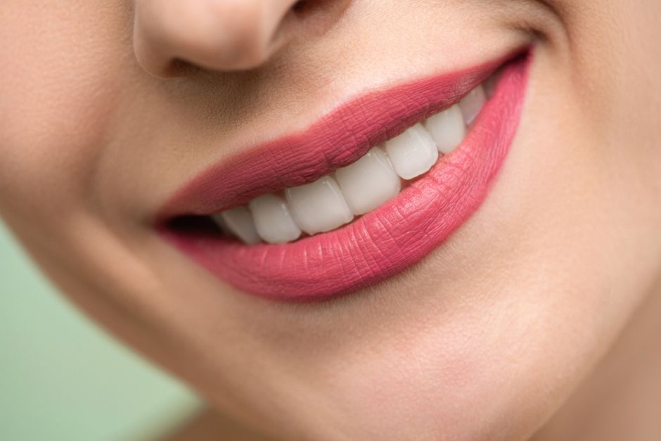 Brighter smile after porcelain veneers in Korea