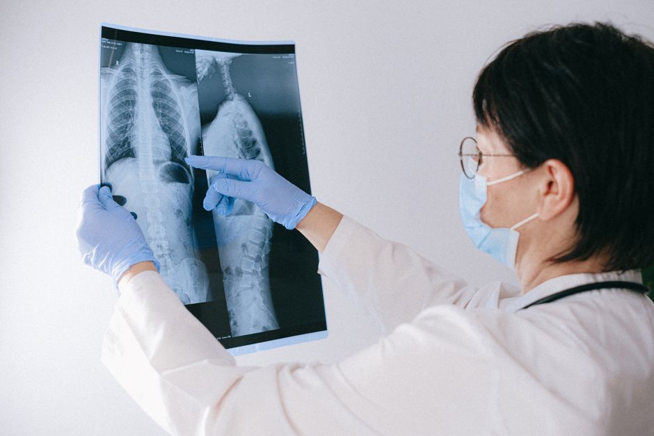 Spine specialist reviewing MRI scans before spinal fusion in Korea
