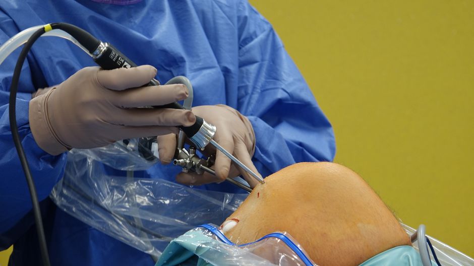 Knee Replacement