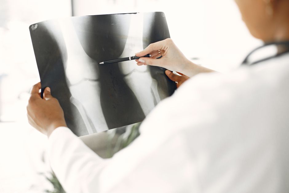 Limb Lengthening
