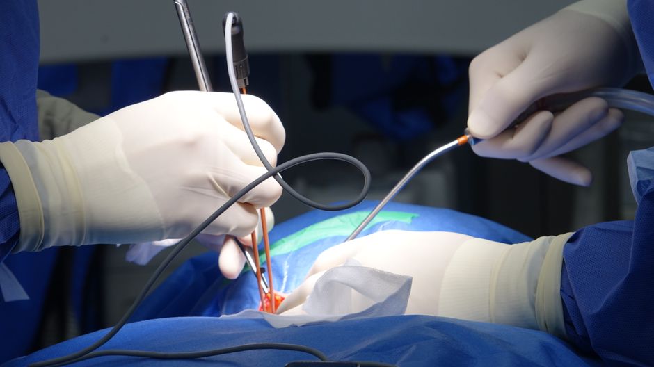 Minimally Invasive Spine Surgery