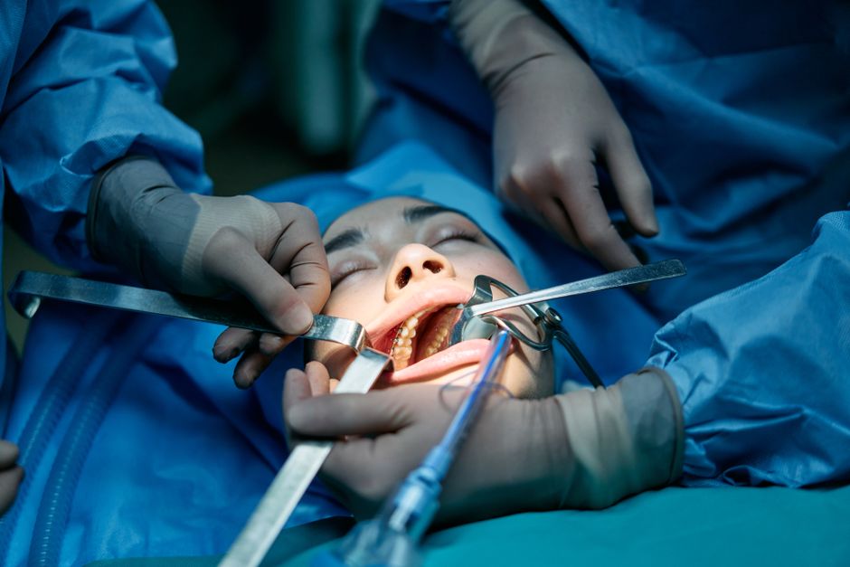 Oral and Maxillofacial Surgery