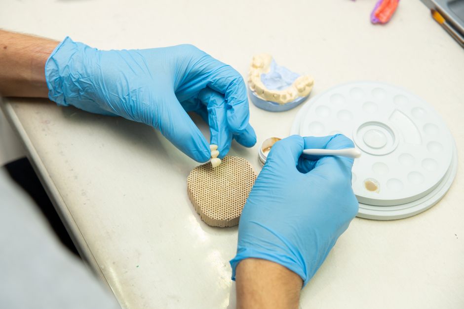 Prosthodontic Treatment