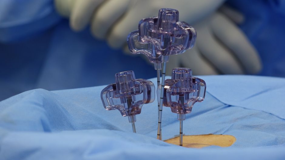 Transforaminal Endoscopic Lumbar Discectomy