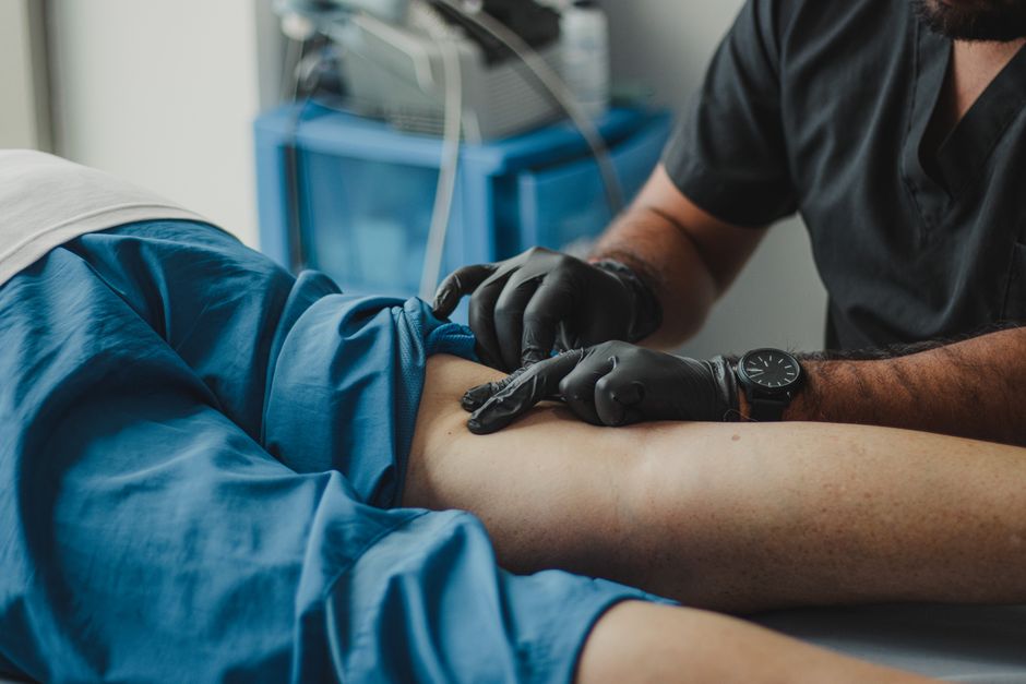 Varicose Vein Treatment